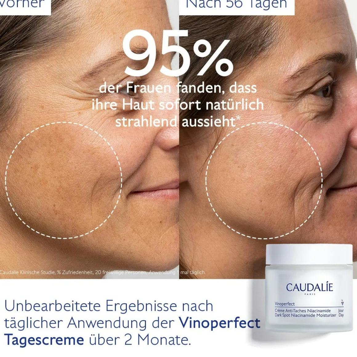 Anti-Pigmentflecken Creme mit Niacinamid & Viniferine