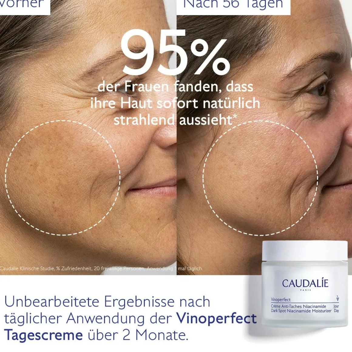 Anti-Pigmentflecken Creme Niacinamid - Nachfüllpackung