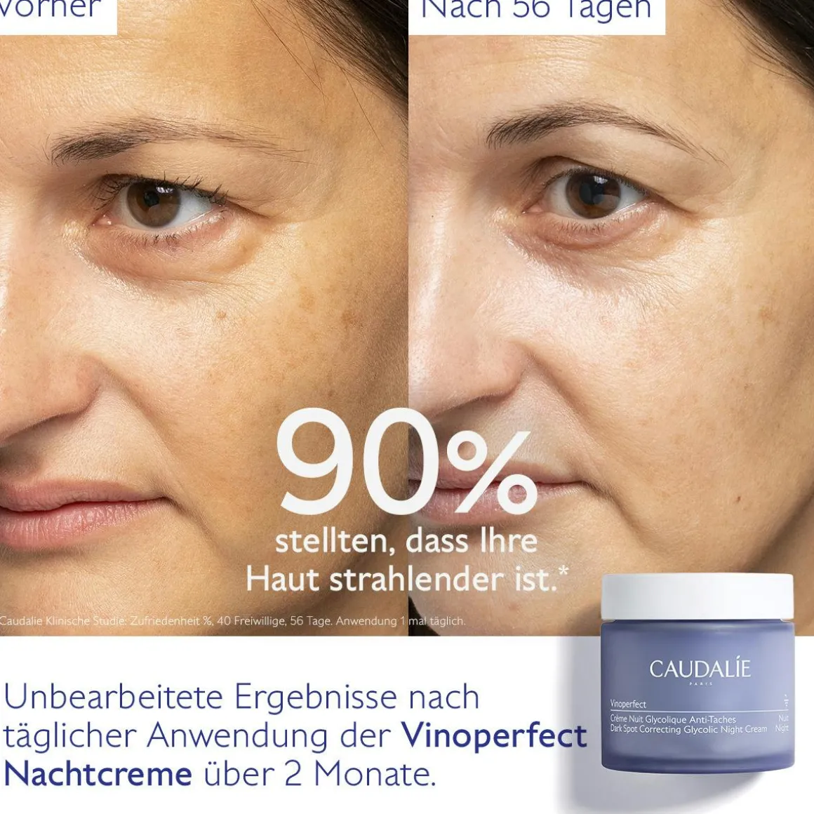 Anti-Pigmentflecken Glykol-Nachtcreme