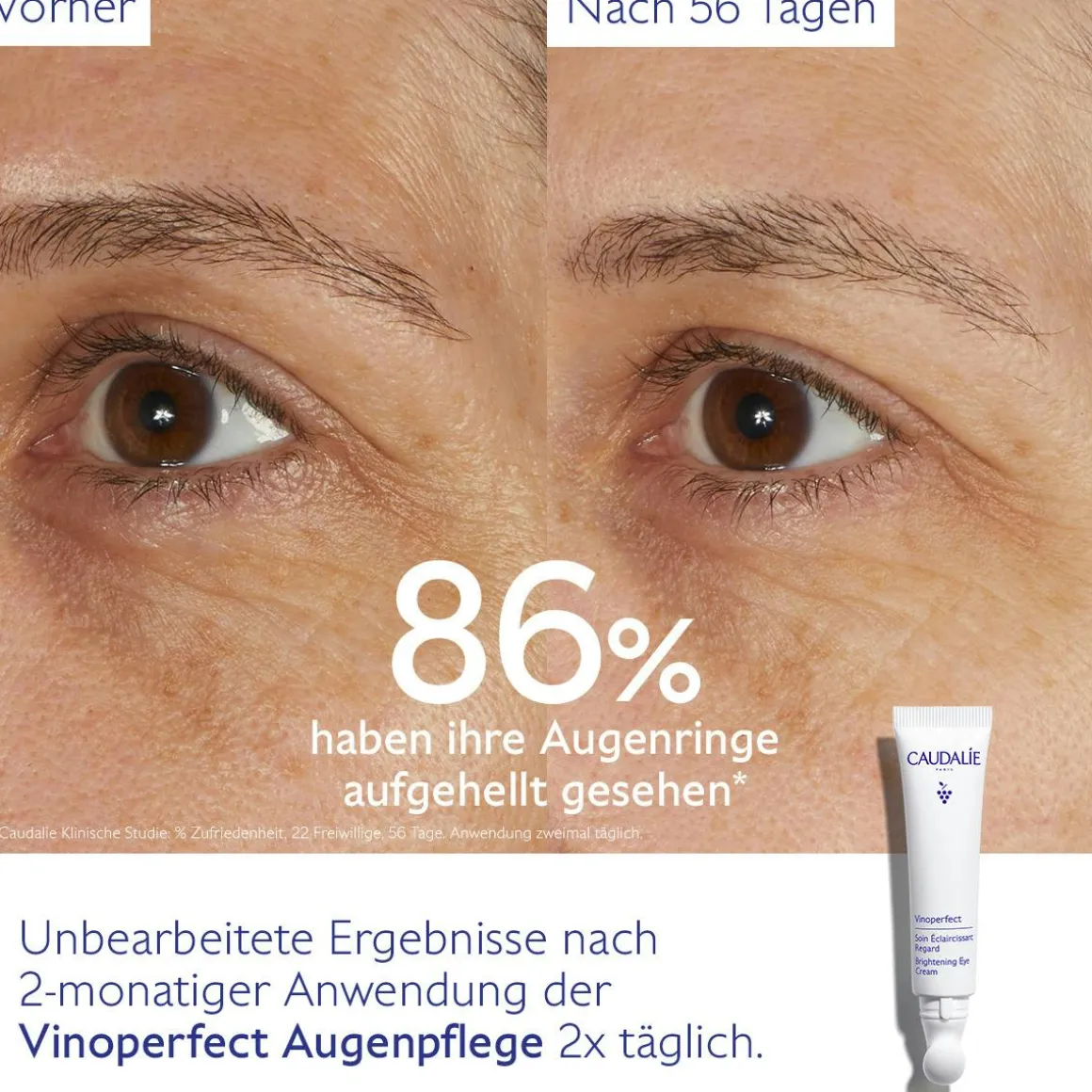 Aufhellende Augenpflege mit Koffein & Niacinamid