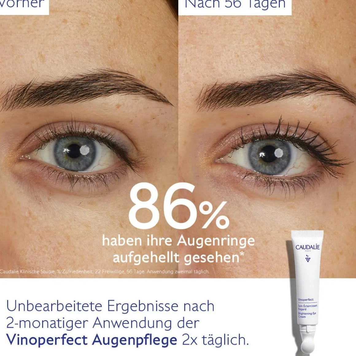 Aufhellende Augenpflege mit Koffein & Niacinamid