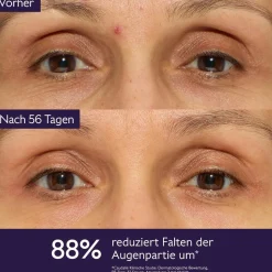 Die Augencreme