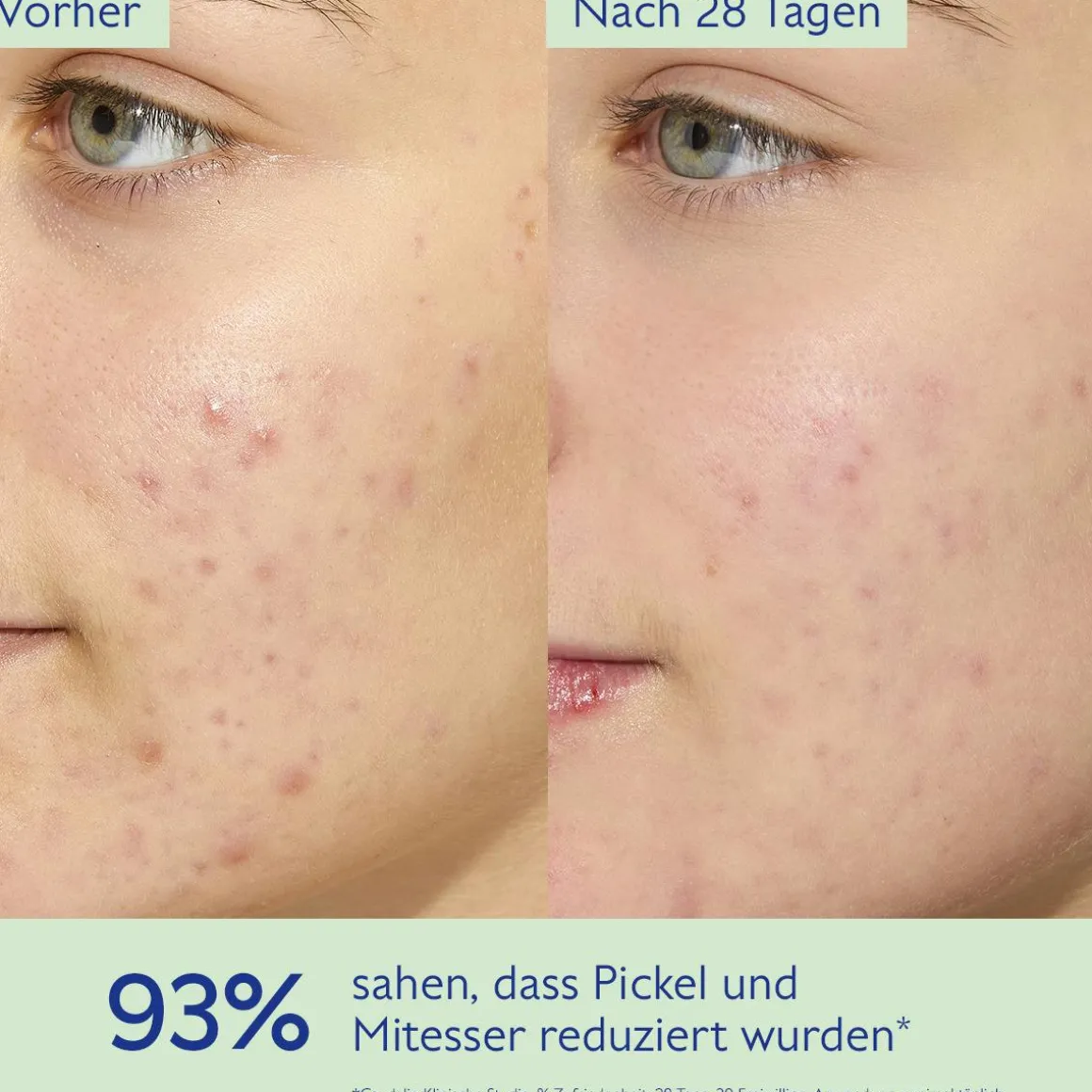Mattierendes Feuchtigkeit spendendes Fluid mit Siliziumpulver