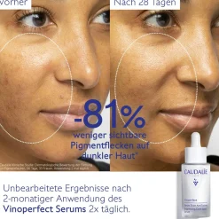 Serum für mehr Ausstrahlung und gegen Pigmentflecken mit Viniferine, Alternative zu Vitamin C - 30ml