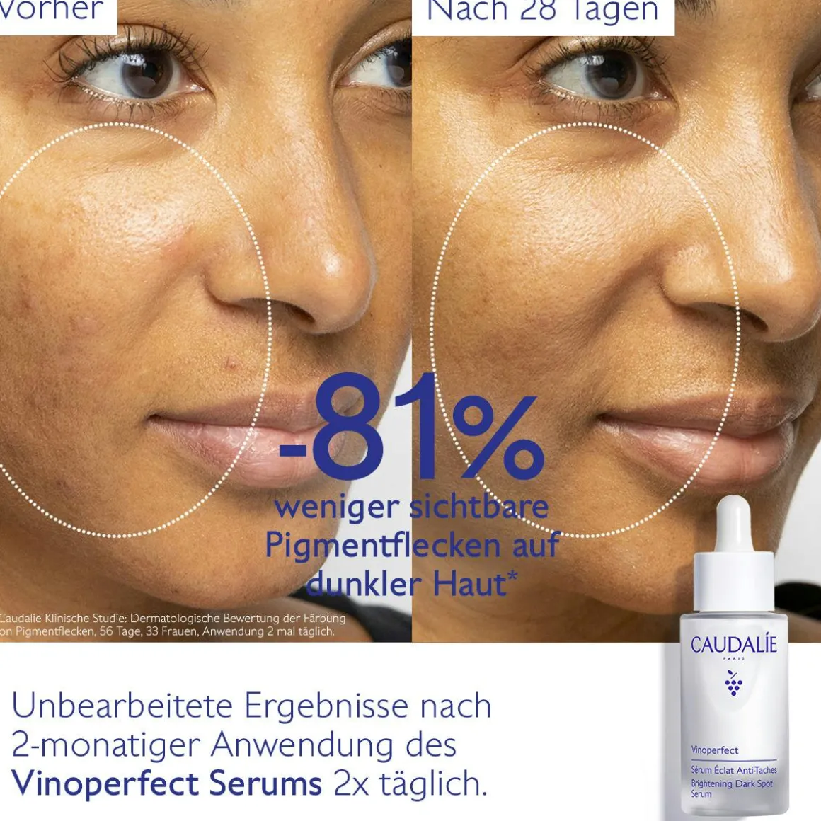 Serum für mehr Ausstrahlung und gegen Pigmentflecken mit Viniferine, Alternative zu Vitamin C - 30ml