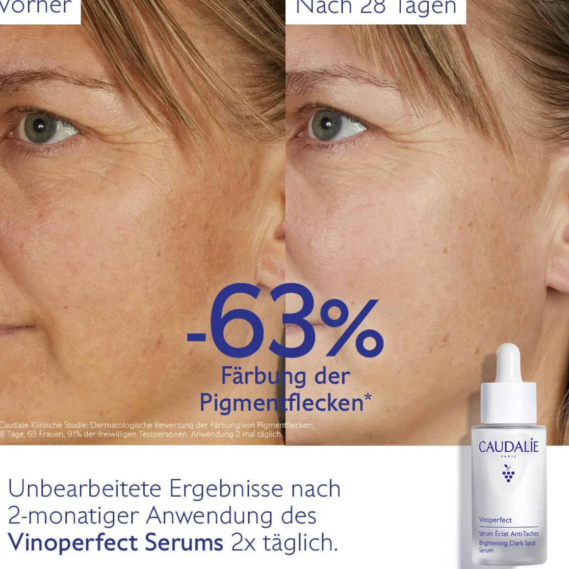 Serum für mehr Ausstrahlung und gegen Pigmentflecken mit Viniferine, Alternative zu Vitamin C - 30ml